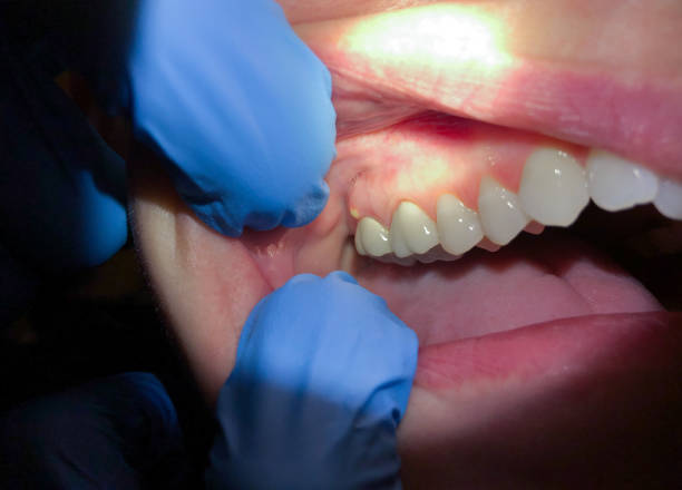 Best After-Hours Dental Care in Fort Polk North, LA